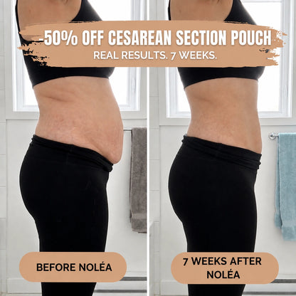 Postpartum Compression Briefs — 360° Compression