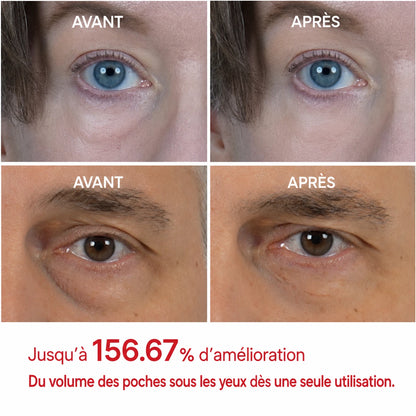 [TikTok Viral Bestseller] Korean Eyephalt™ contour des yeux anti-poches