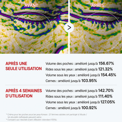 [TikTok Viral Bestseller] Korean Eyephalt™ contour des yeux anti-poches