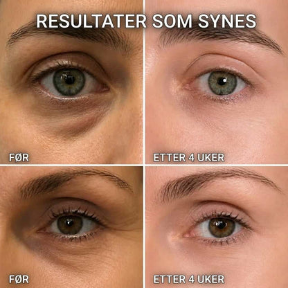 Bio-Kollagen & PDRN-stift