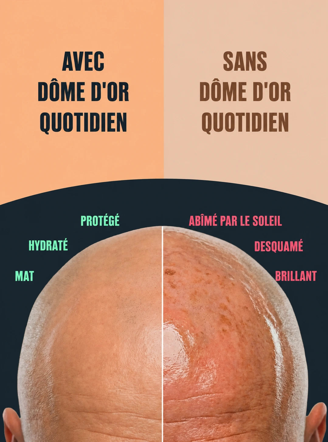 DÔME D'OR - LE N°1 DES CHAUVES