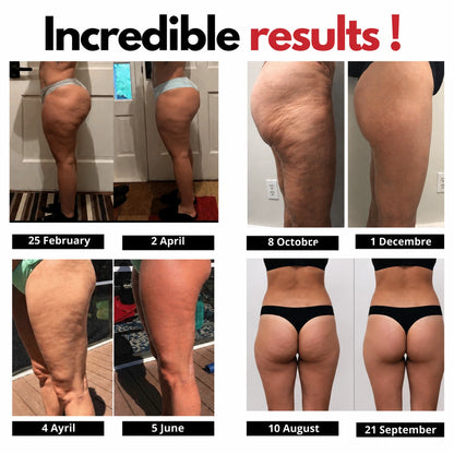 Noléa 3D Legging